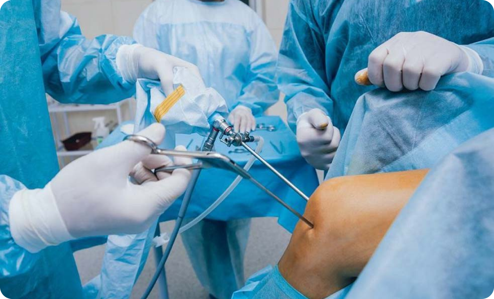Arthroscopy and Sports Injuries
