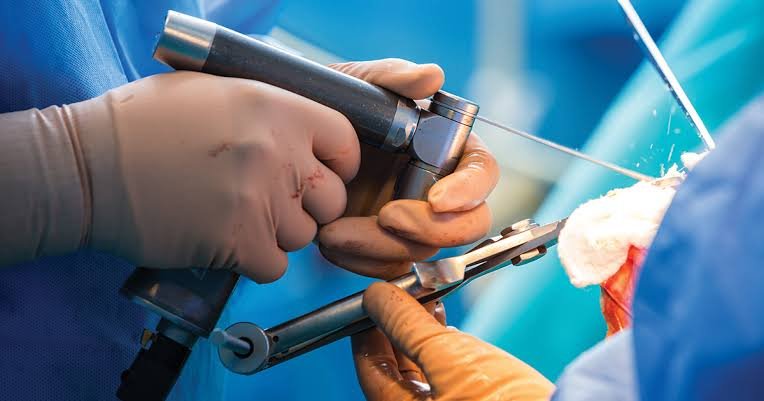 Orthopaedic Trauma Surgery